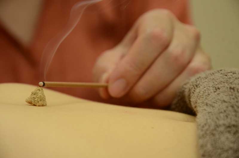 Acumiho - Acupuncture & Moxibustion Acumiho - Acupuncture & Moxibustion
