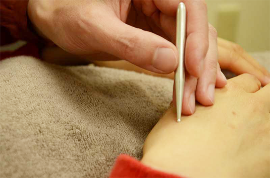 Acumiho Moxibustion - Tenkyu Procedure Acumiho Moxibustion - Tenkyu Procedure