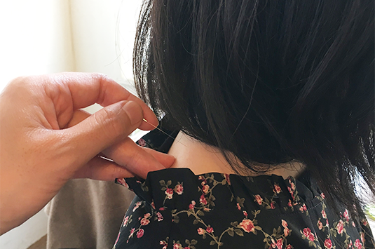 Acumiho Moxibustion - Tenkyu Procedure Acumiho Moxibustion - Tenkyu Procedure